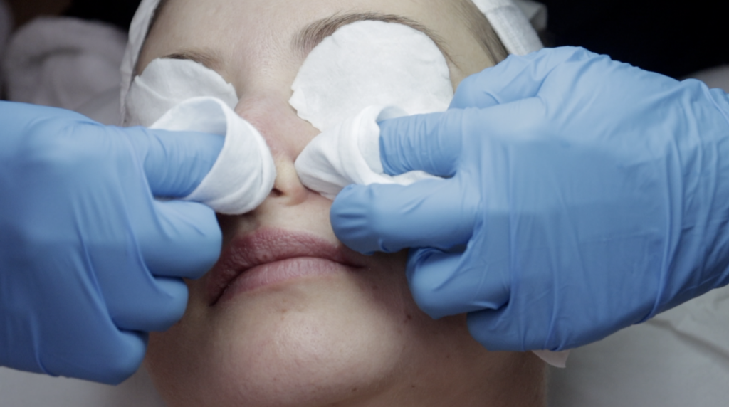 step by step professional facial guide step 6 extracting blackheads and whiteheads